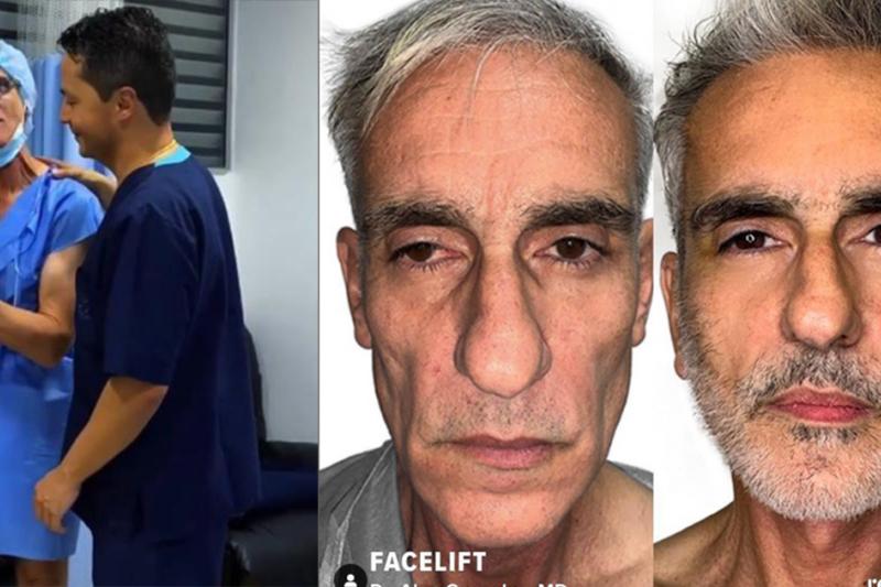 Revelan más fotos de cómo quedó Miguel Varoni tras cirugía lo dejaron
